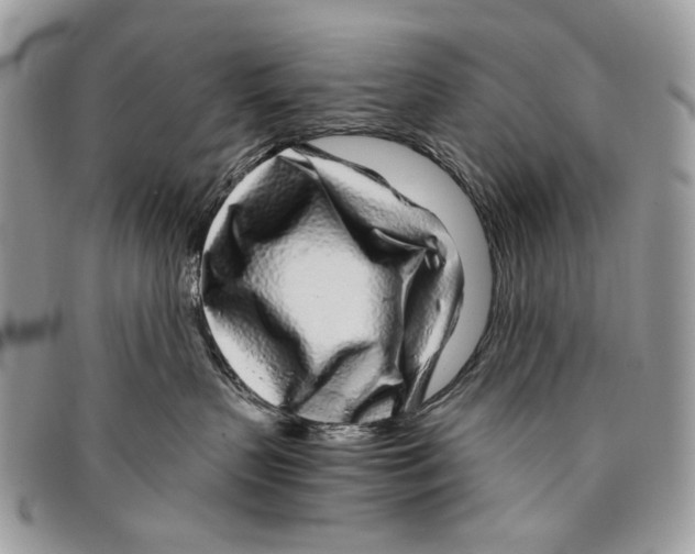 X0000096420383200802141640