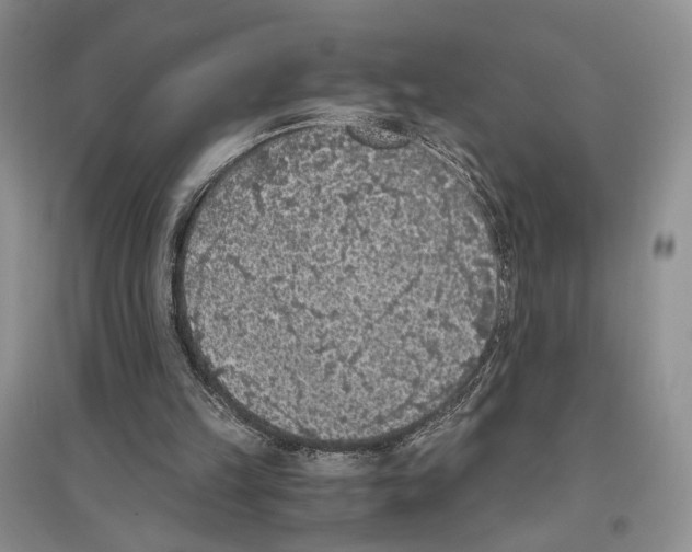 X0000096420149200802211131