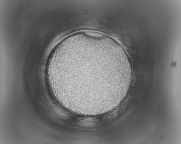 X0000096420151200802211131