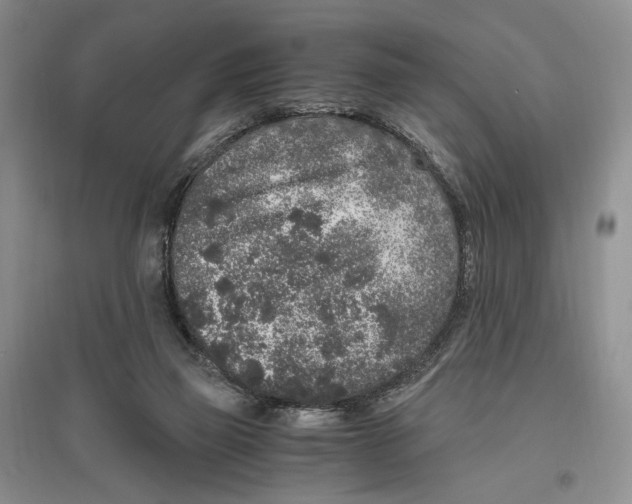 X0000096420165200802211131
