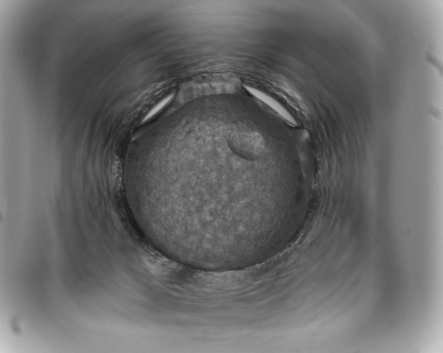 X0000096430029200802071735