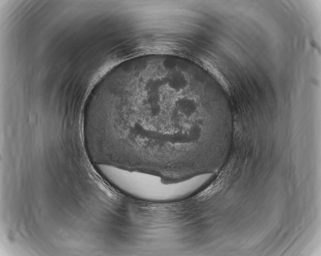 X0000096431035200802071721
