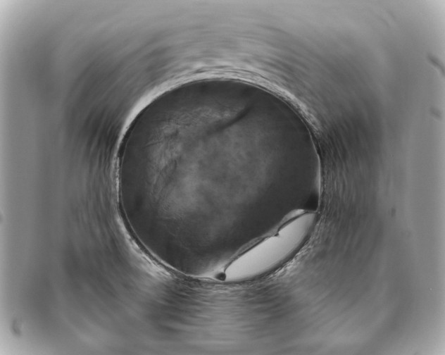 X0000096431522200802071714