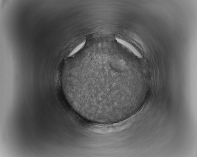 X0000096430029200802141441