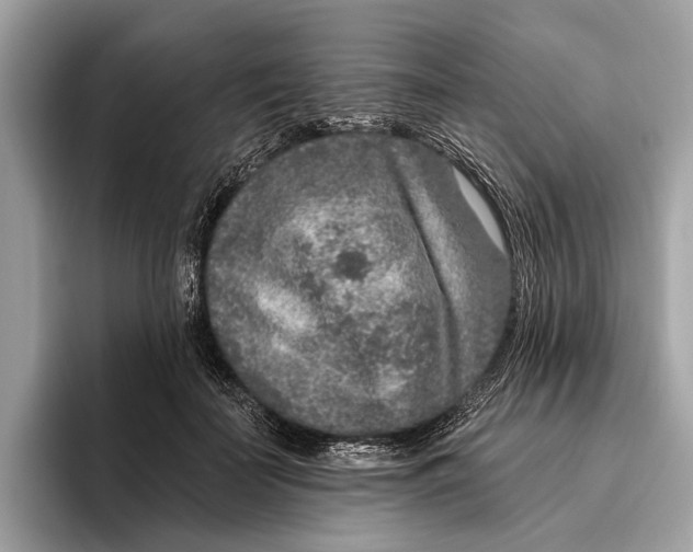 X0000096430699200802141432
