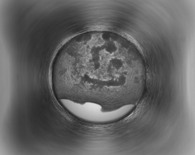 X0000096431035200802141428