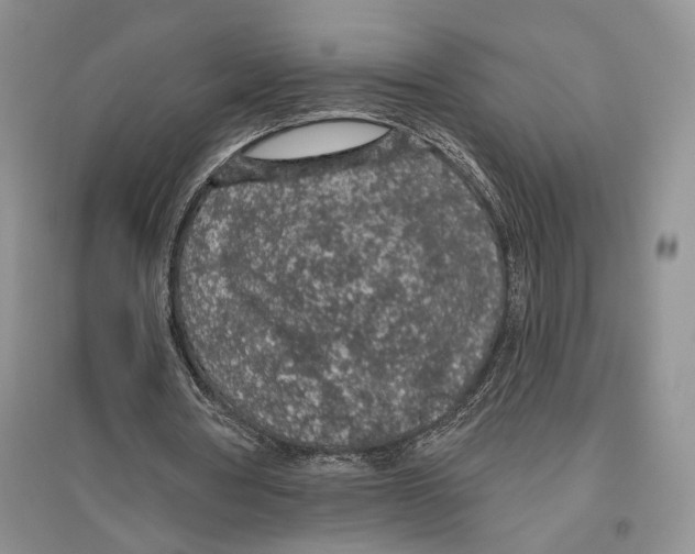 X0000096430386200802211152