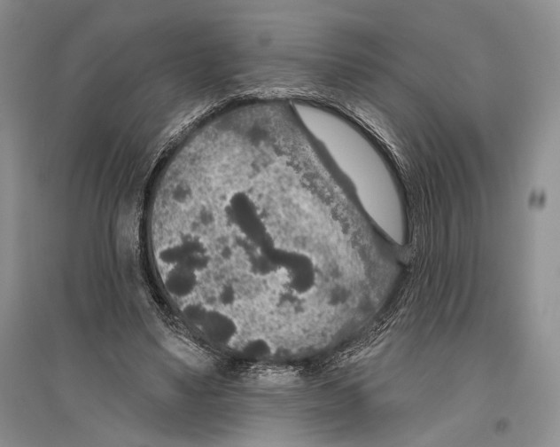X0000096430491200802211150