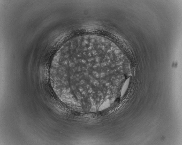 X0000096431155200802211140