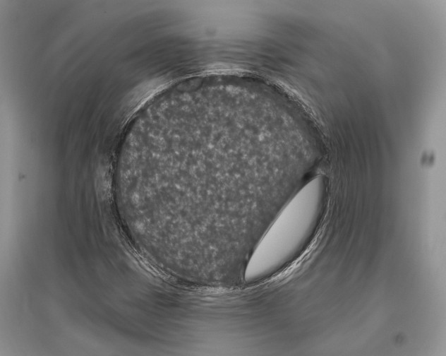 X0000096431401200802211136