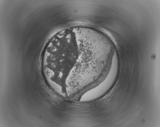 X0000096431419200802211136