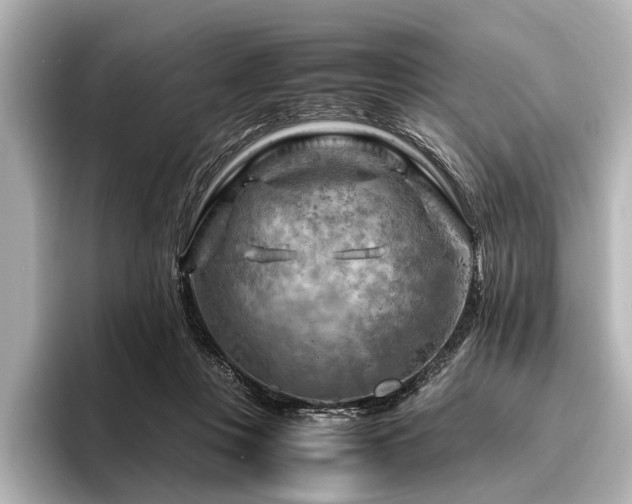 X0000096440359200801241403