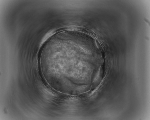 X0000096440198200801311436