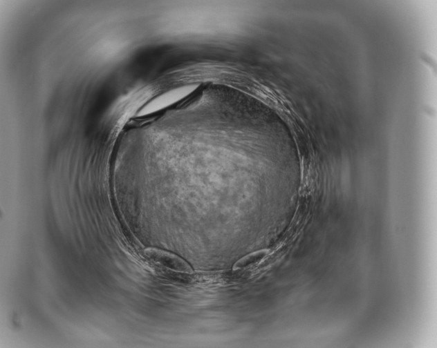 X0000096440099200802071757