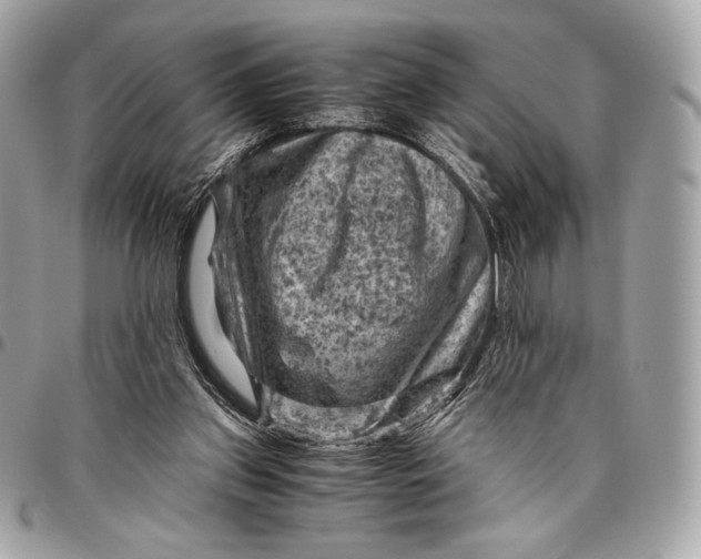 X0000096440157200802071756