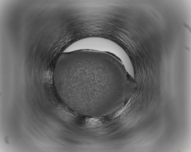 X0000096440180200802071757