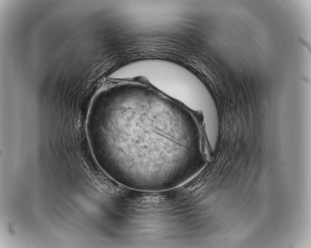 X0000096440314200802071754