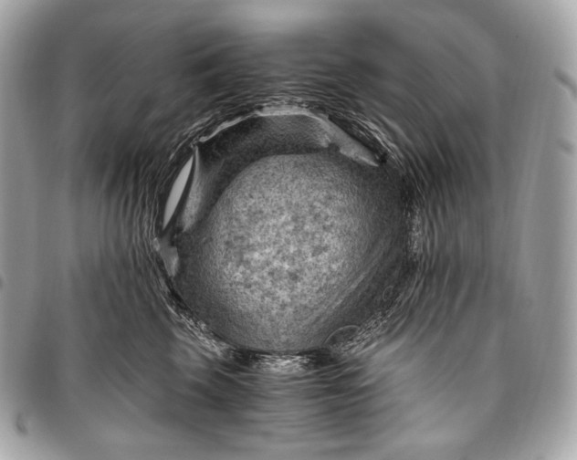 X0000096440569200802071751