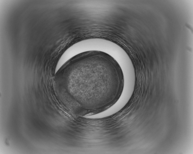 X0000096440617200802071750