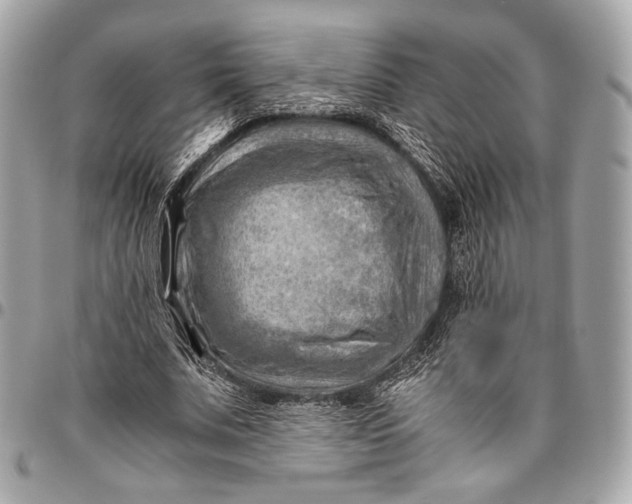 X0000096440679200802071749