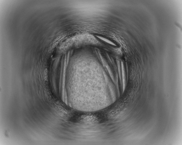 X0000096440689200802071748