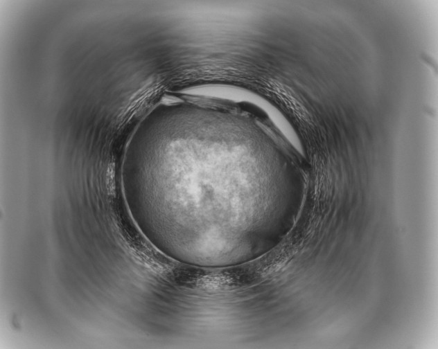 X0000096440696200802071748