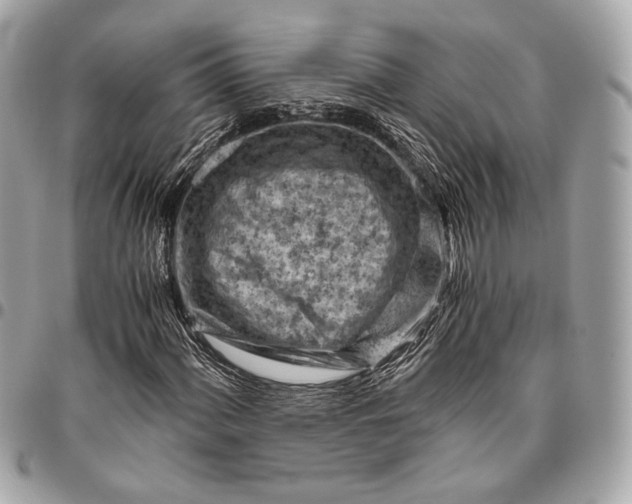 X0000096441060200802071743