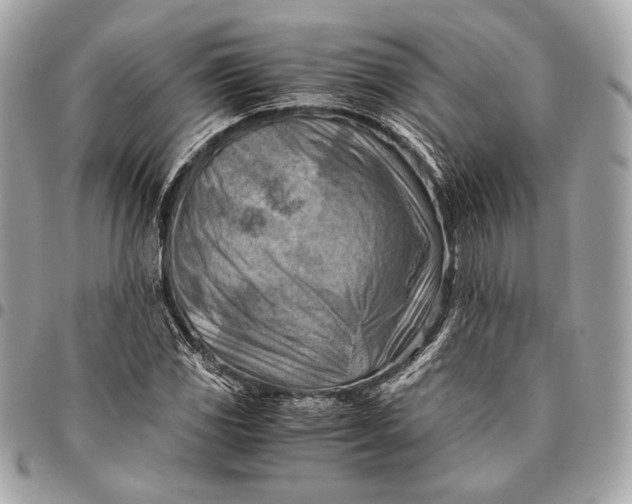 X0000096441117200802071742