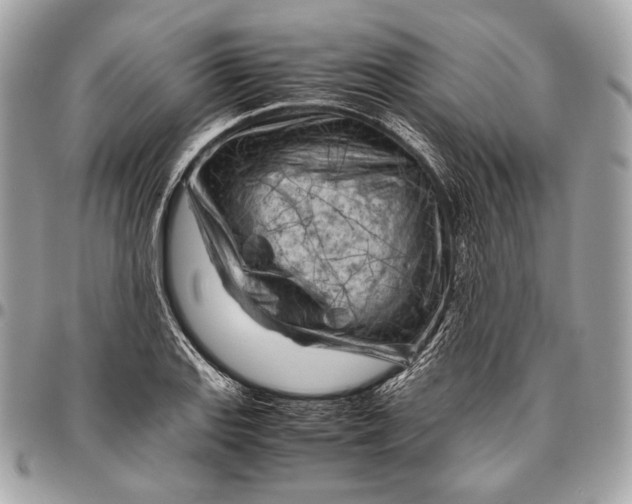 X0000096441127200802071742