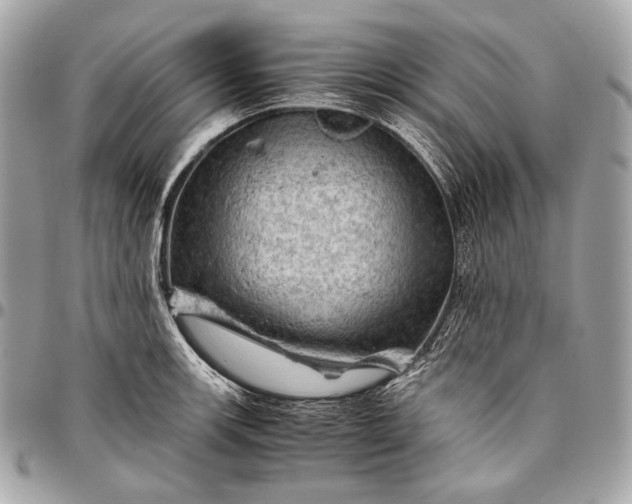 X0000096441139200802071742