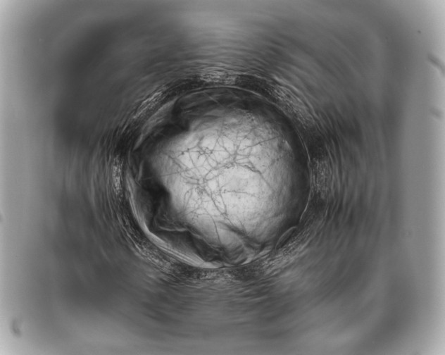 X0000096441154200802071742