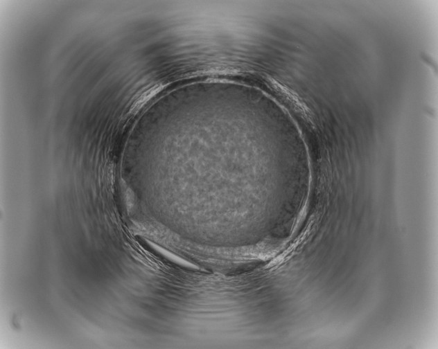 X0000096441169200802071741