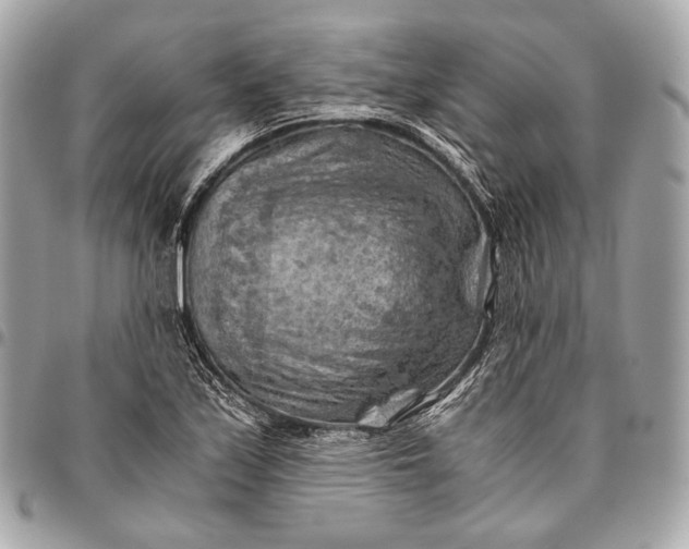 X0000096441171200802071741