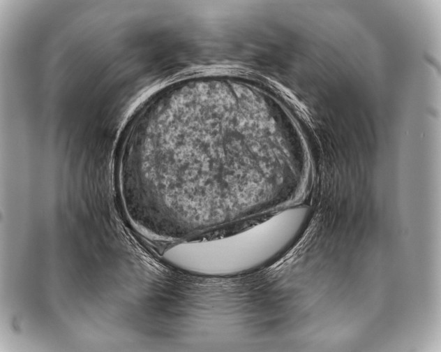 X0000096441174200802071741