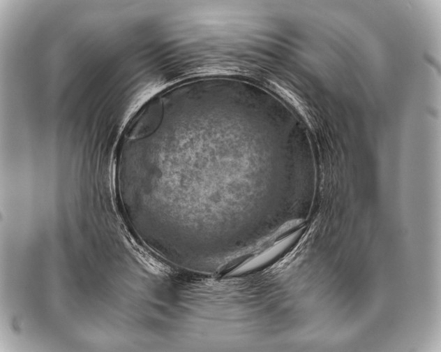 X0000096441179200802071741