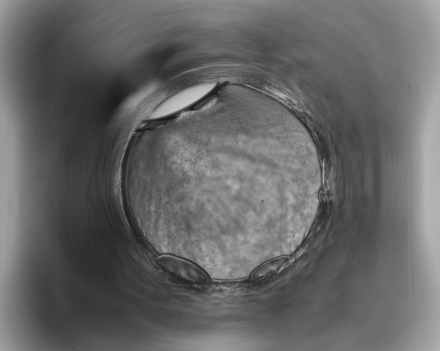 X0000096440099200802141500