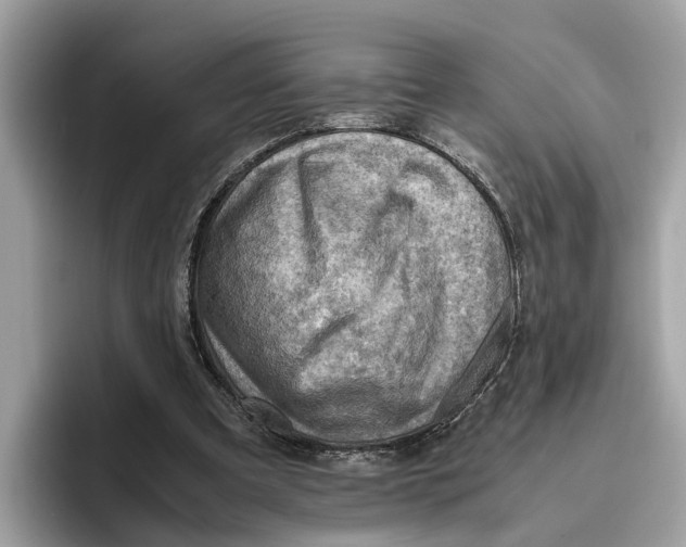 X0000096440297200802141457