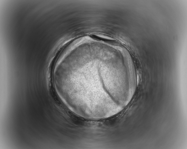 X0000096440339200802141456