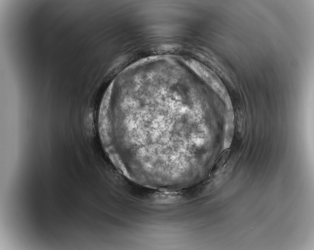 X0000096440378200802141457