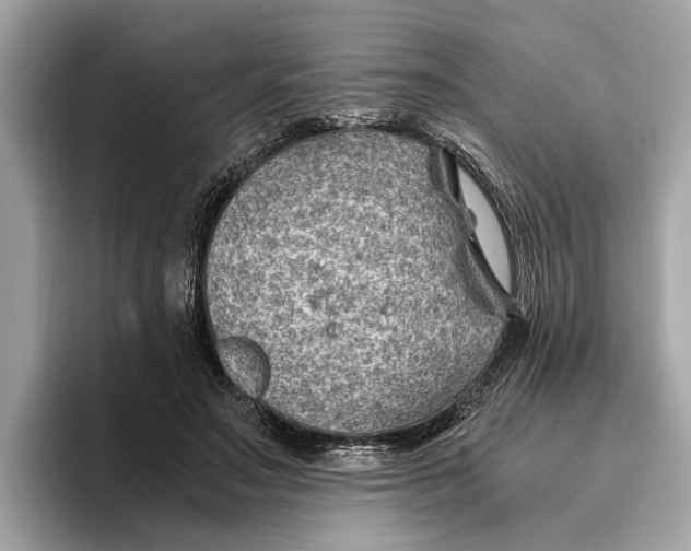 X0000096440499200802141455