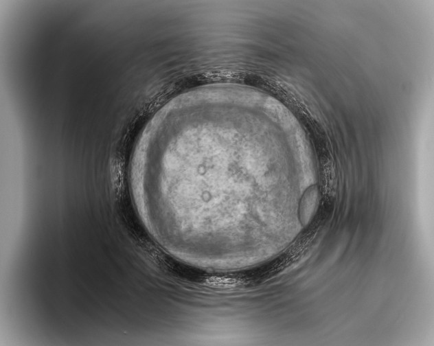 X0000096440699200802141452