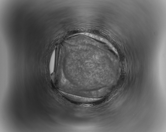 X0000096440711200802141452