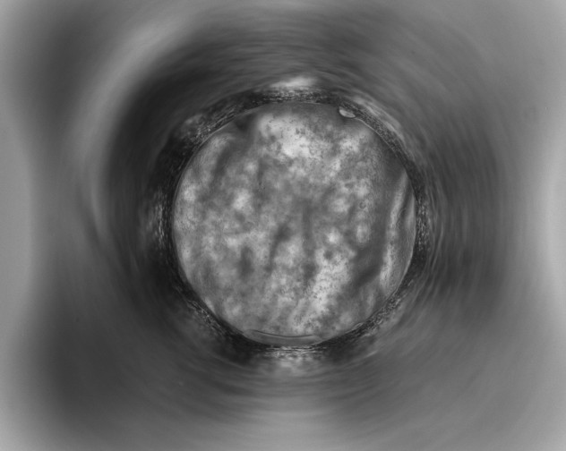 X0000096440762200802141452