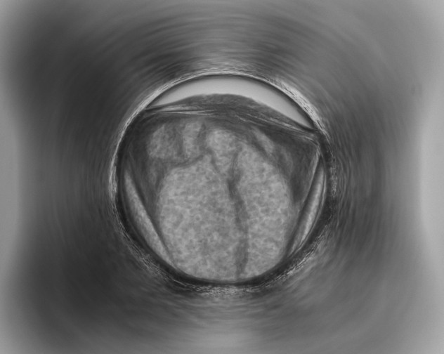 X0000096440885200802141449