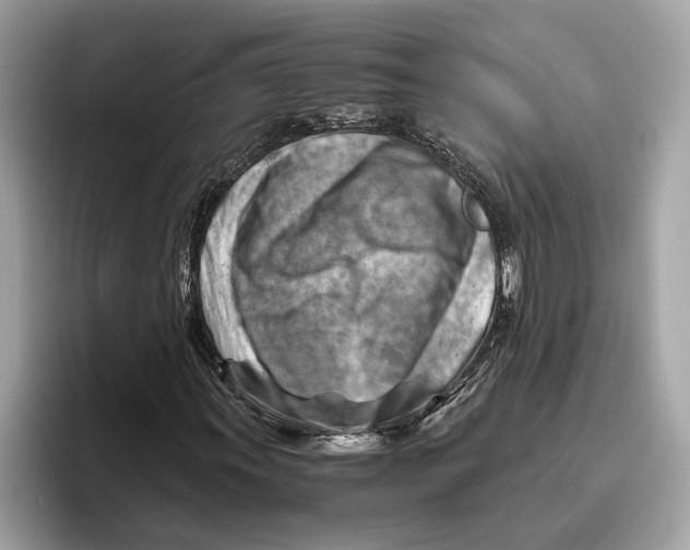 X0000096441011200802141447