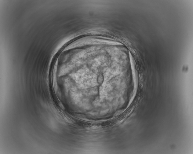 X0000096440196200802211218