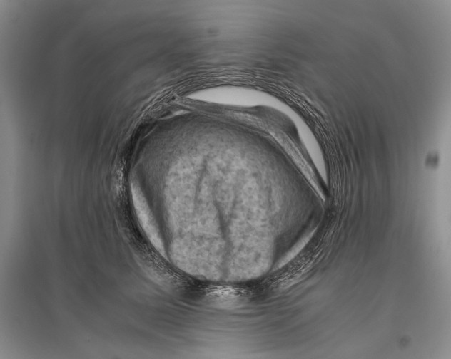 X0000096440611200802211212