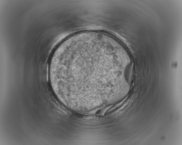 X0000096441171200802211203