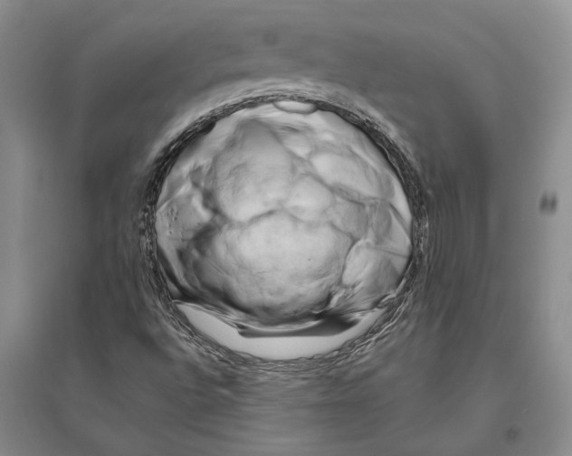 X0000096441496200802211158