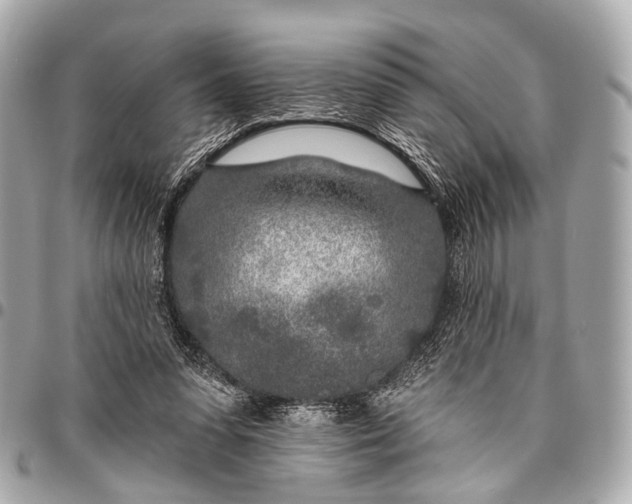 X0000096450303200802071818